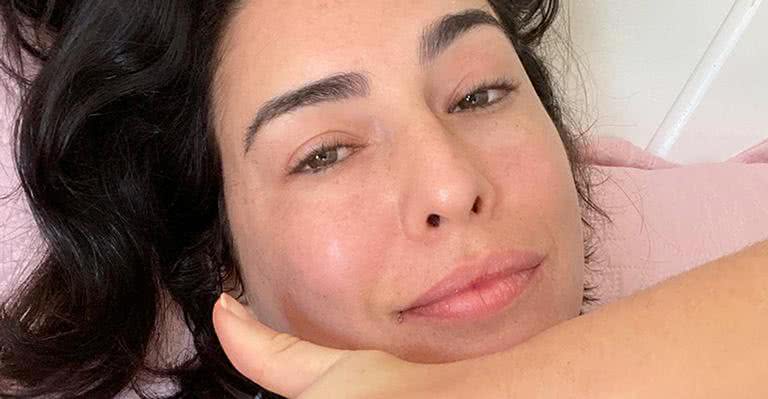 Fernanda Paes Leme tranquiliza fãs após passar por cirurgia delicada: "Foi tudo bem" - Instagram