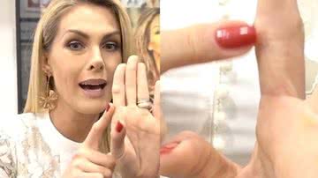 Ana Hickmann passa por cirurgia - Instagram