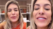 Lorena Improta mostra antes e depois de preenchimento labial e botox - Arquivo Pessoal