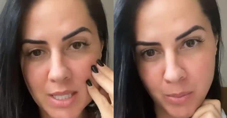 Noiva de Zezé di Camargo se explica após rosto mudar - Reprodução/Instagram