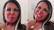 Gretchen fala sobre plásticas e se defende de críticas - Instagram