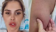 Bárbara Evans passa por cirurgia para a remoção de gordura localizada que a incomodava - Reprodução/Instagram