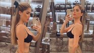 Bárbara Evans mostra hematomas no braço após realizar lipoaspiração - Reprodução/Instagram