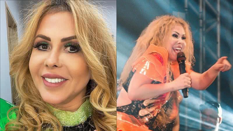 Joelma surge irreconhecível após inchaço no rosto e explica causa: "Tá cuidando" - Reprodução/Instagram