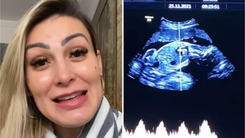 Andressa Urach detalha saúde do filho e celebra fim dos enjoos: “Pude apreciar” - Reprodução/Instagram