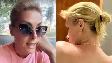 A apresentadora Ana Hickmann sofre acidente, expõe ferimentos e detalha situação; saiba o que aconteceu - Reprodução/Instagram