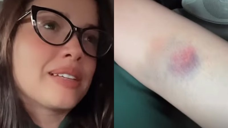 Ex-BBB Juliette mostra hematomas no corpo e explica motivo - Reprodução/Instagram