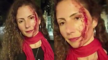 Magalea Mazziotti foi agredida na rua ao andar com um adesivo à favor de Luiz Inácio Lula da Silva - Reprodução/Instagram