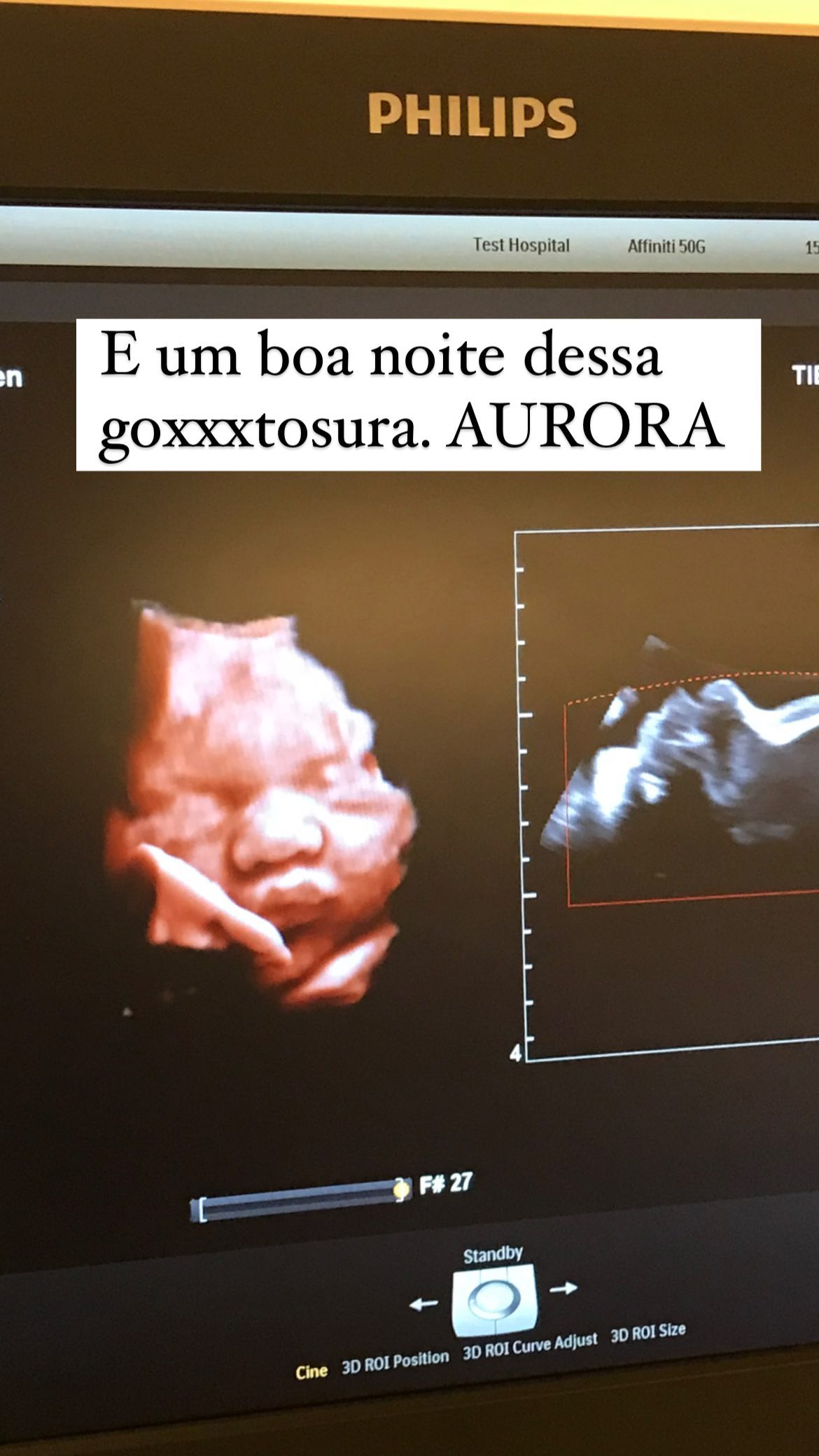 Esposa de Pedro Scooby mostra rostinho da filha em ultrassom e baba: "Gostosura"