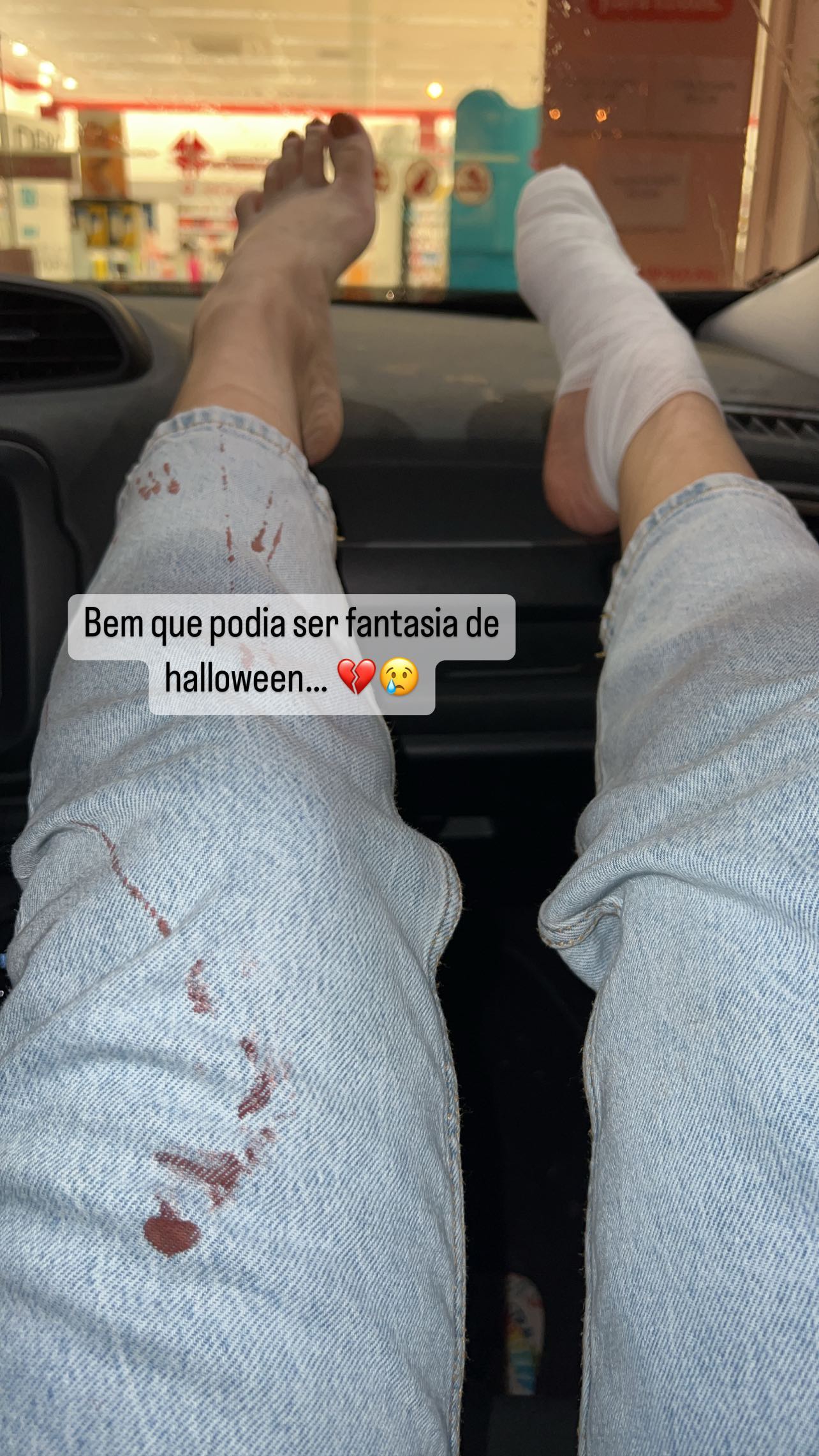 Filha do cantor Leandro, Lyandra fratura o dedo e surge com pé enfaixado e calça coberta se sangue