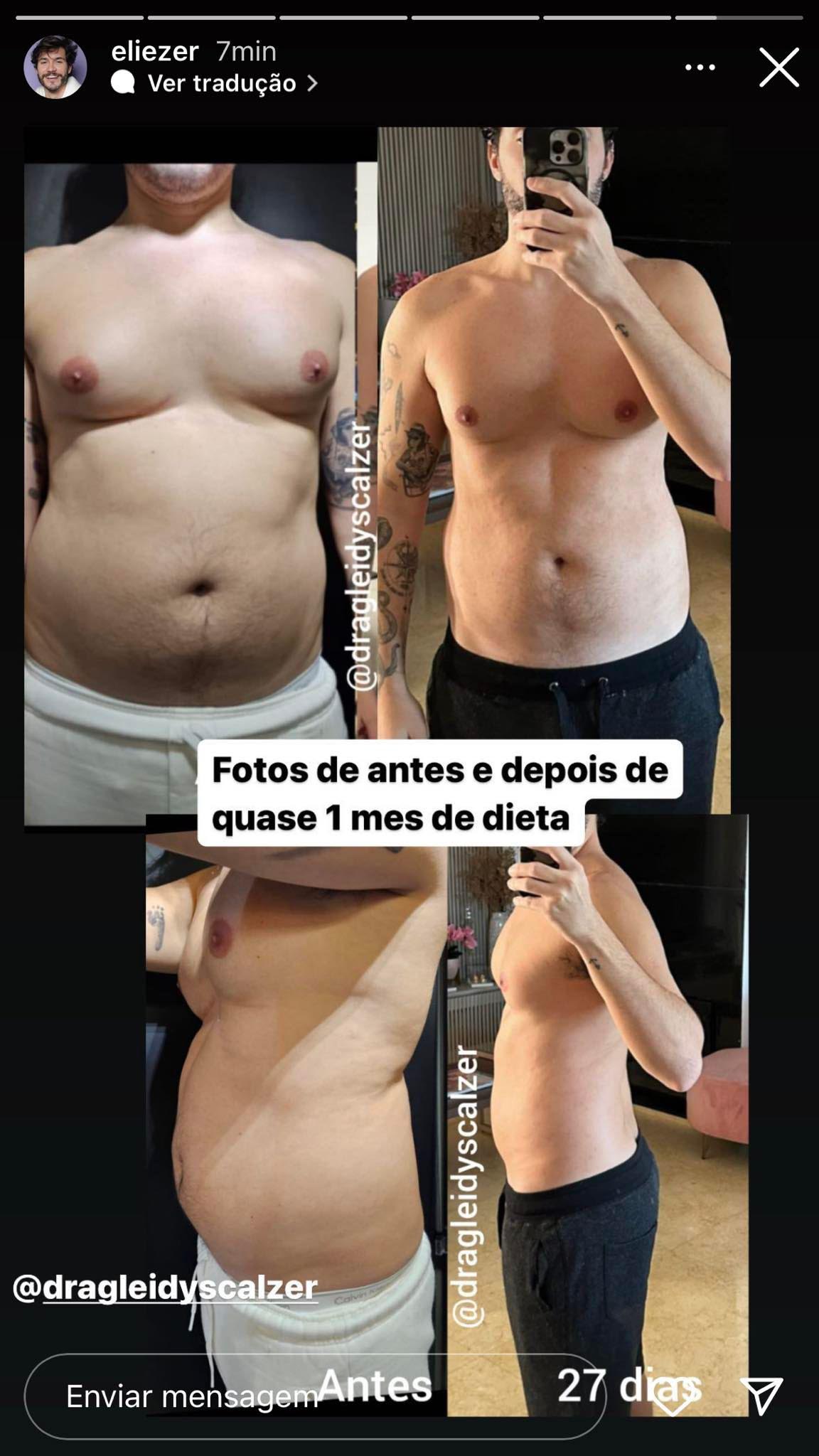 Eliezer antes e depois