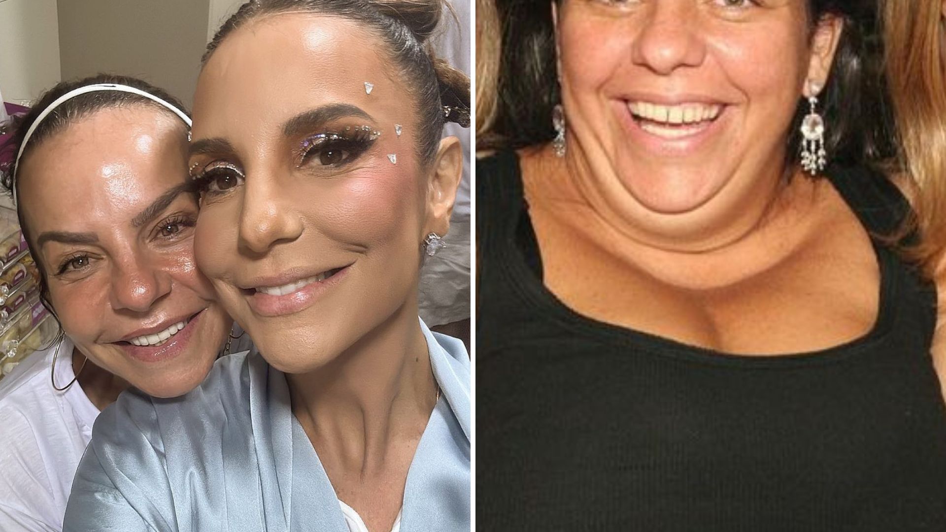 Irmã de Ivete Sangalo surge irreconhecível em antes e depois de cirurgia:  