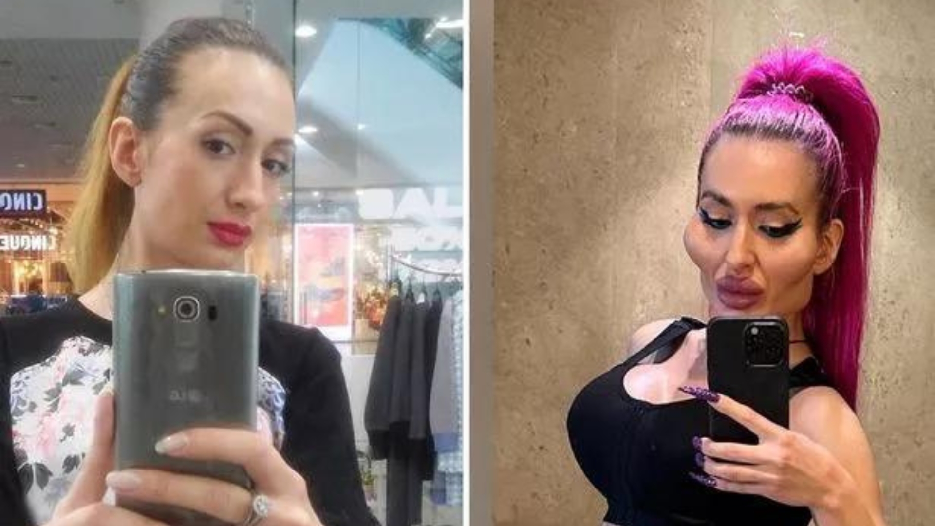 anastasia pokreshchuk antes e depois 