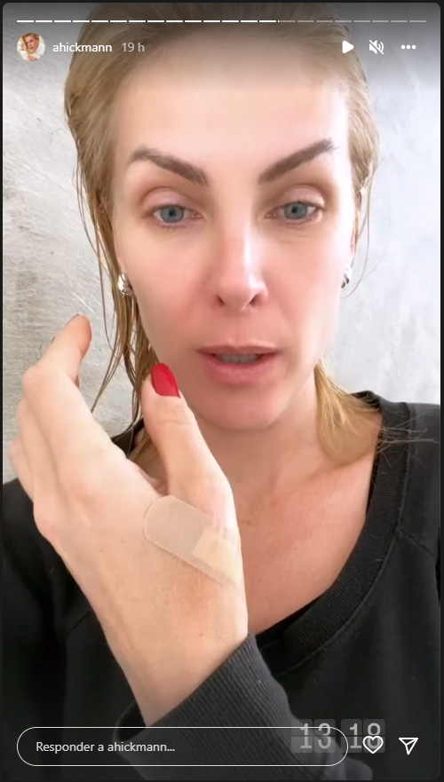 Foto extraída dos Stories de Ana Hickmann mostrando curativo de machucado