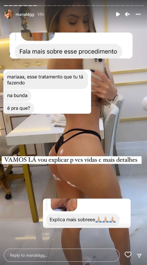 Maria Lina faz procedimento no bumbum