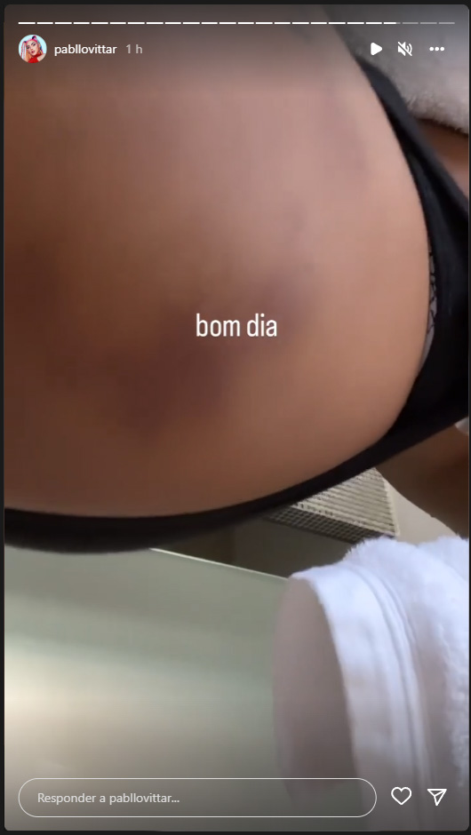 Foto de Pabllo Vittar mostrando hematoma no bumbum com os escritos "Bom dia"