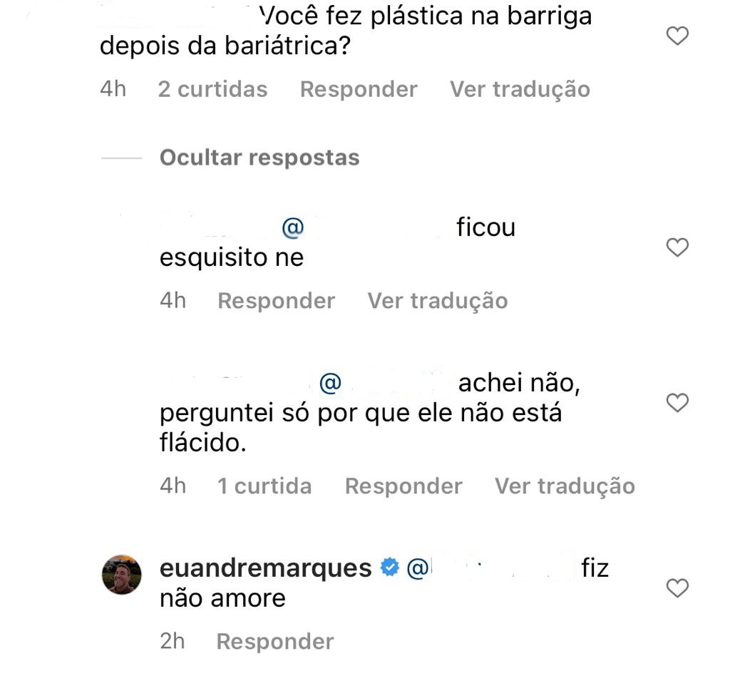 André Marques foi questionado se fez uma cirurgia plástica após sua bariátrica 