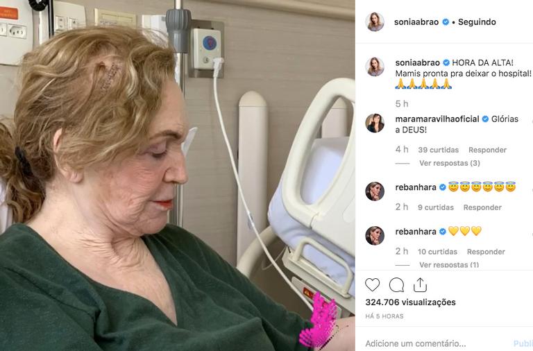 Sonia Abrão impressiona ao mostrar cicatriz de sua mãe após cirurgia na cabeça