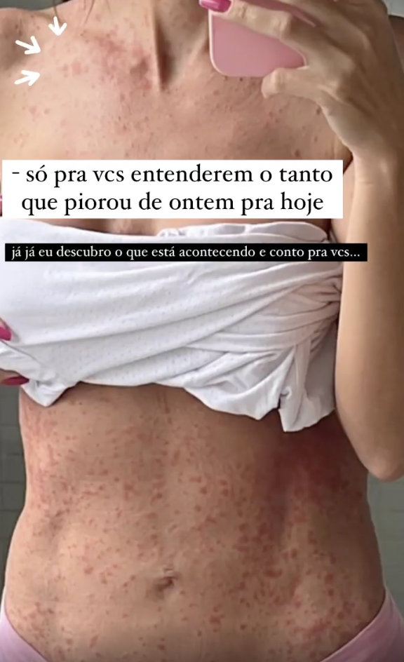 Letícia Santiago: inflamações