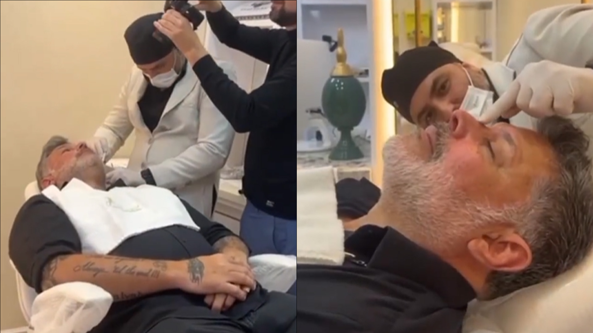 Alexandre Frota faz harmonização facial e causa revolta: “Não tava falido?”