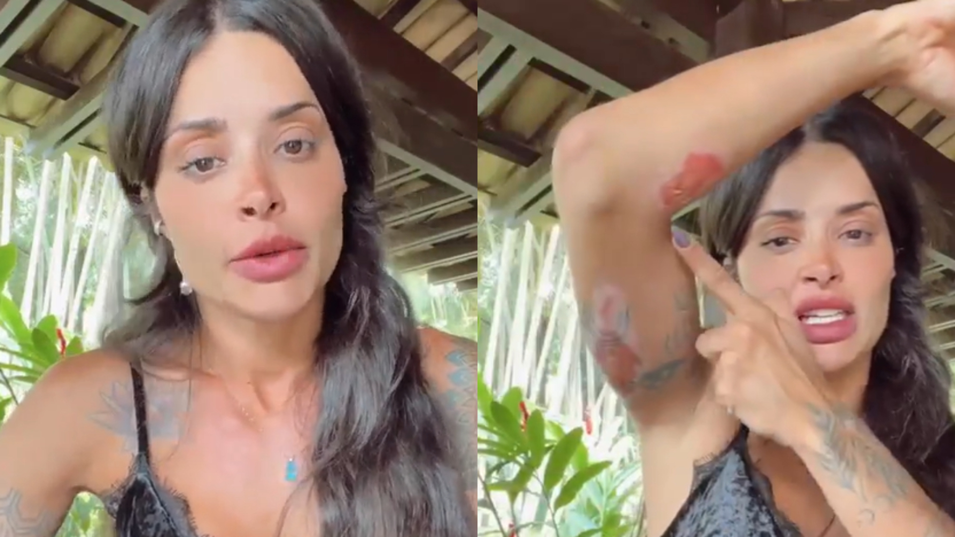 Aline Campos sofre acidente de moto e surge coberta de ferimentos: “Carne viva”