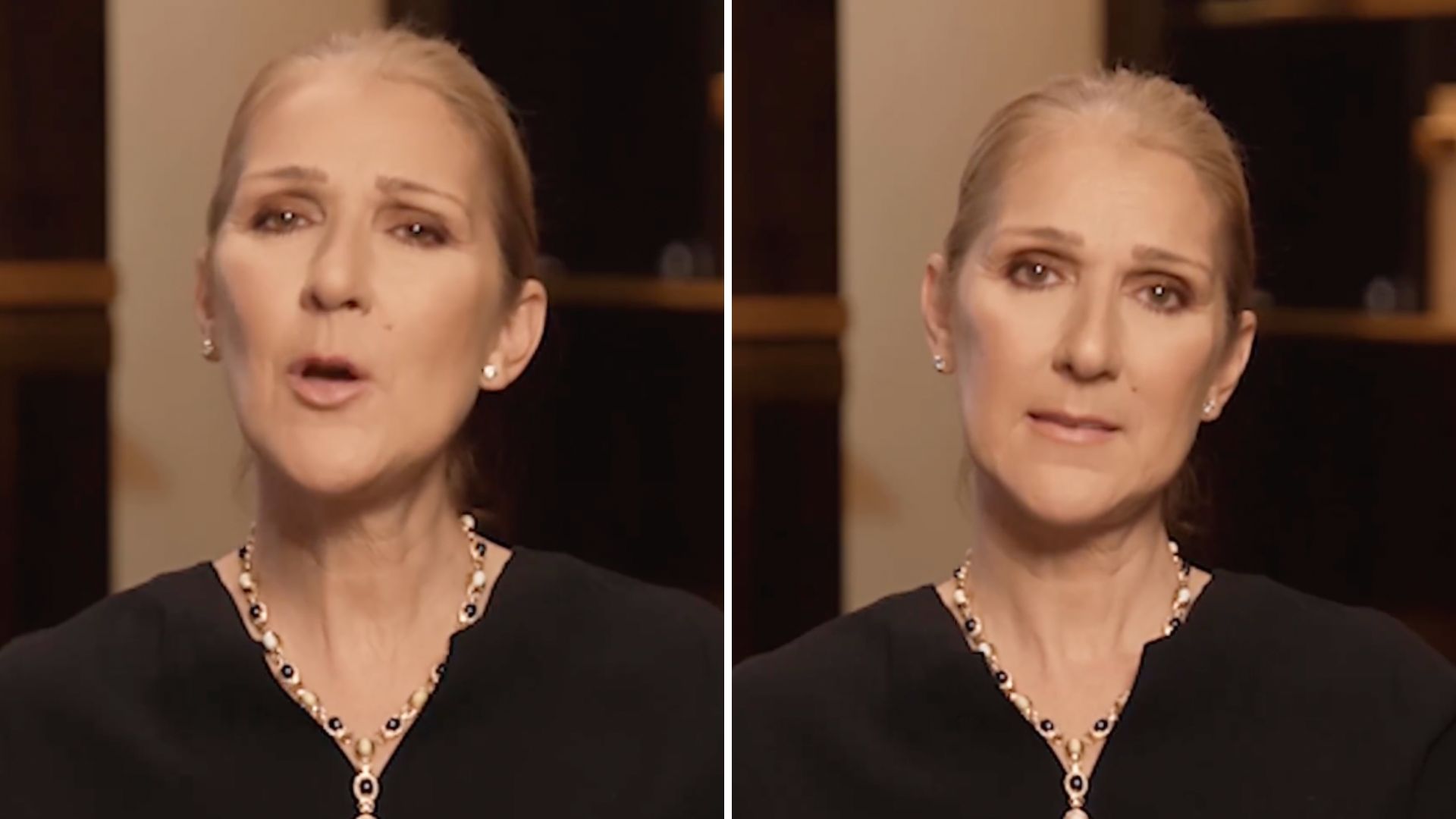Celine Dion diz que pode se tornar uma ‘estátua humana’ após diagnóstico de doença rara