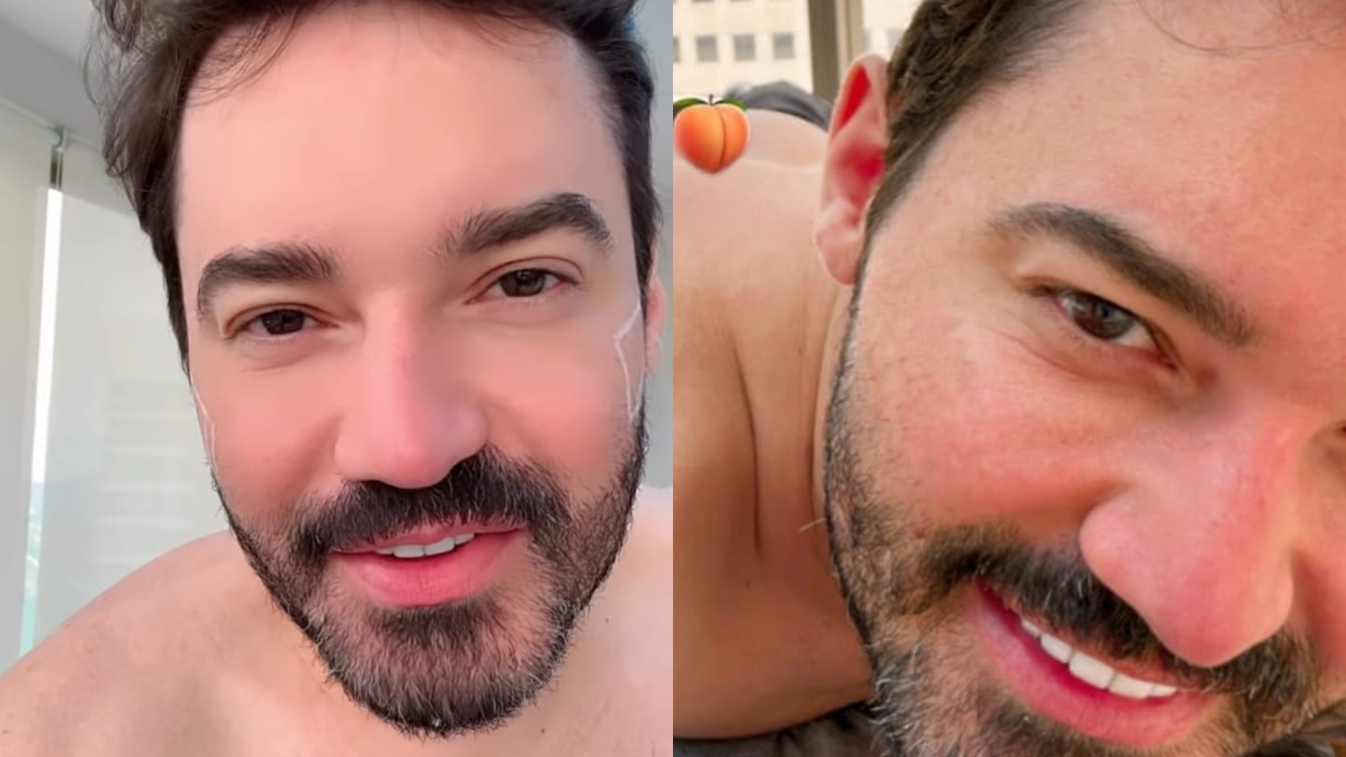 Fernando Zor faz procedimento estético para aumentar o bumbubm: “Corpinho escultural”