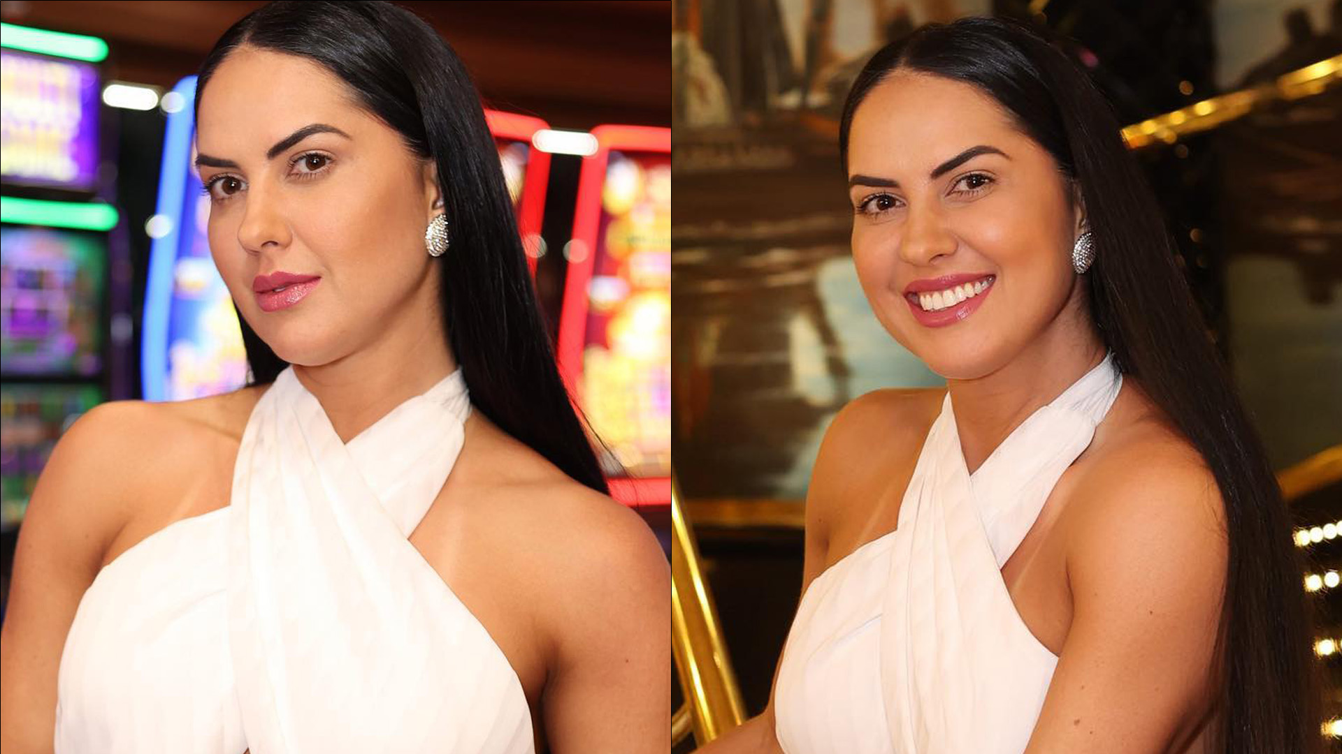 Graciele Lacerda faz procedimento no rosto e fãs se assustam: “Tá muito diferente”