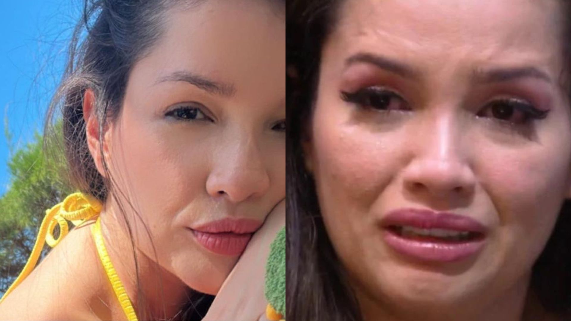 Ex-BBB Juliette sofre queimadura durante viagem e preocupa fãs: “Pense numa dor”