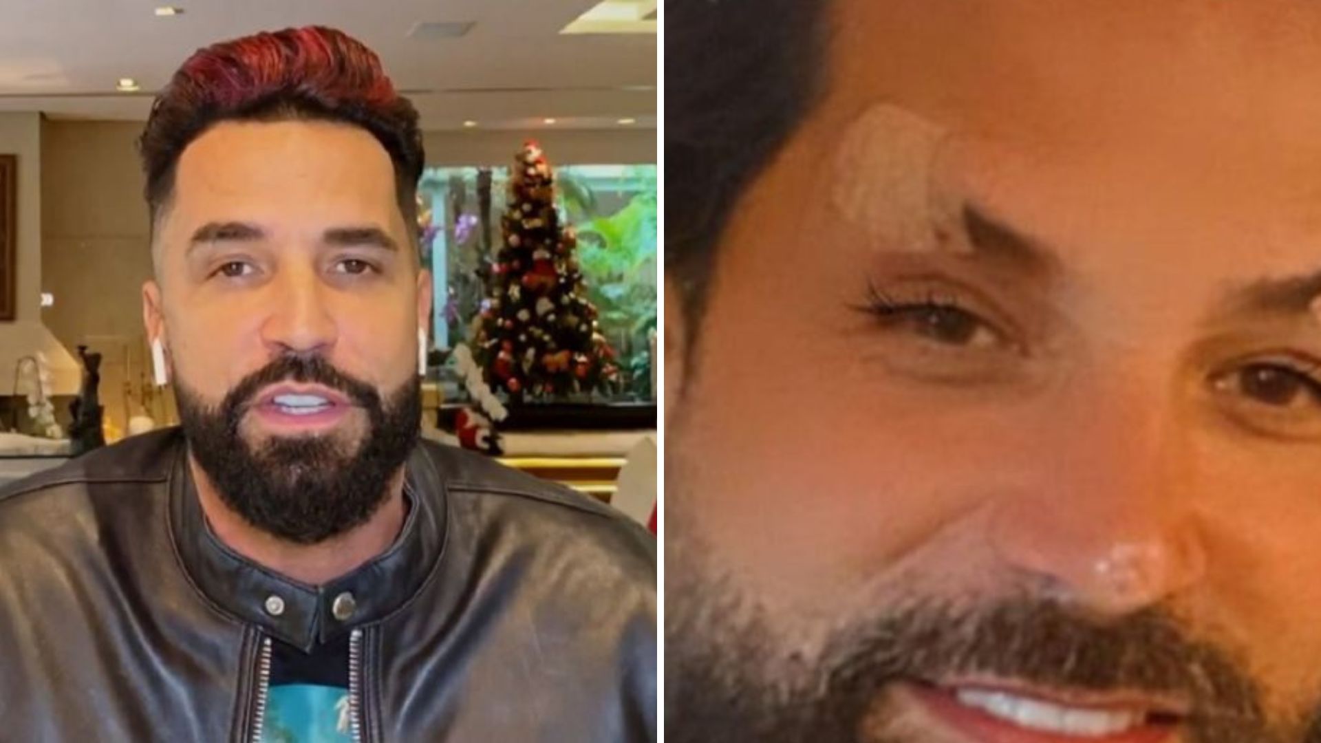 Latino surge irreconhecível após harmonização facial e vira chacota: “Horror”