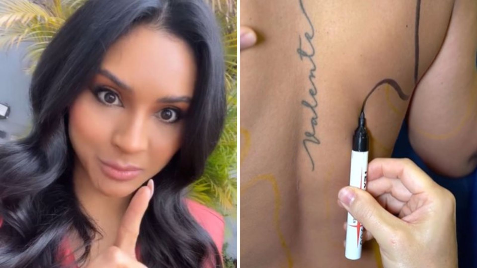 Mileide Mihaile tem conta astronômica para pagar após fazer lipo LAD; saiba quanto
