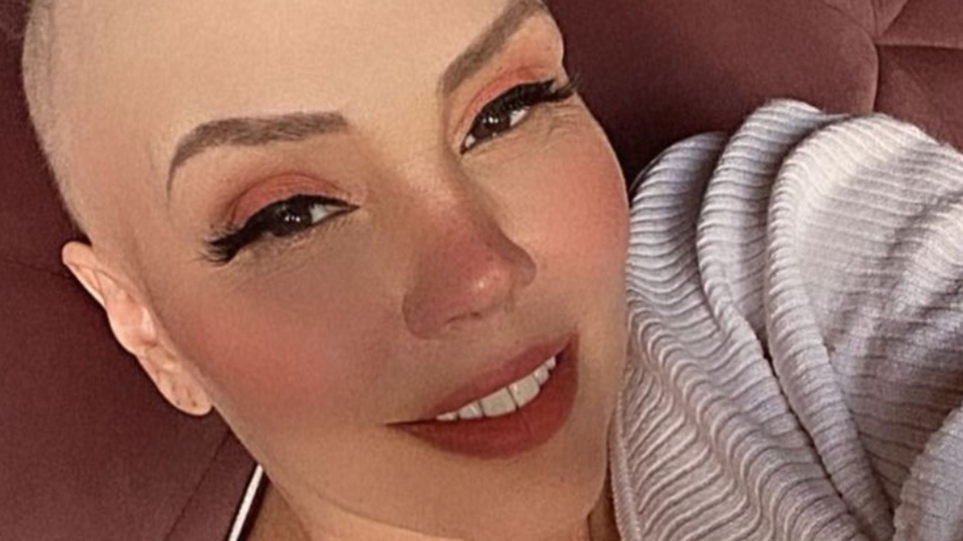 Simony posa careca e dá notícia comovente aos fãs: “Hoje é meu dia de renascimento”