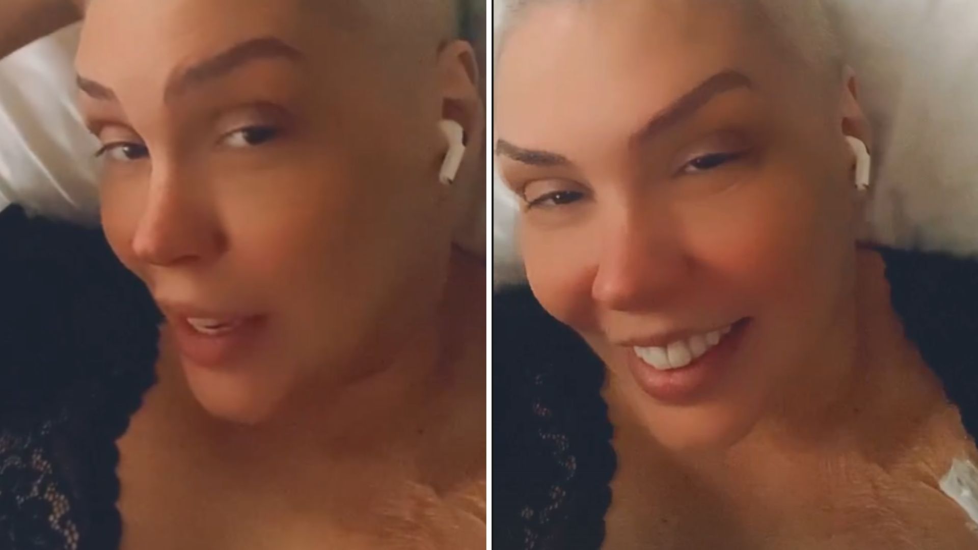 Após fim da quimioterapia, Simony se alegra ao mostrar cabelo crescendo: “Grandão”
