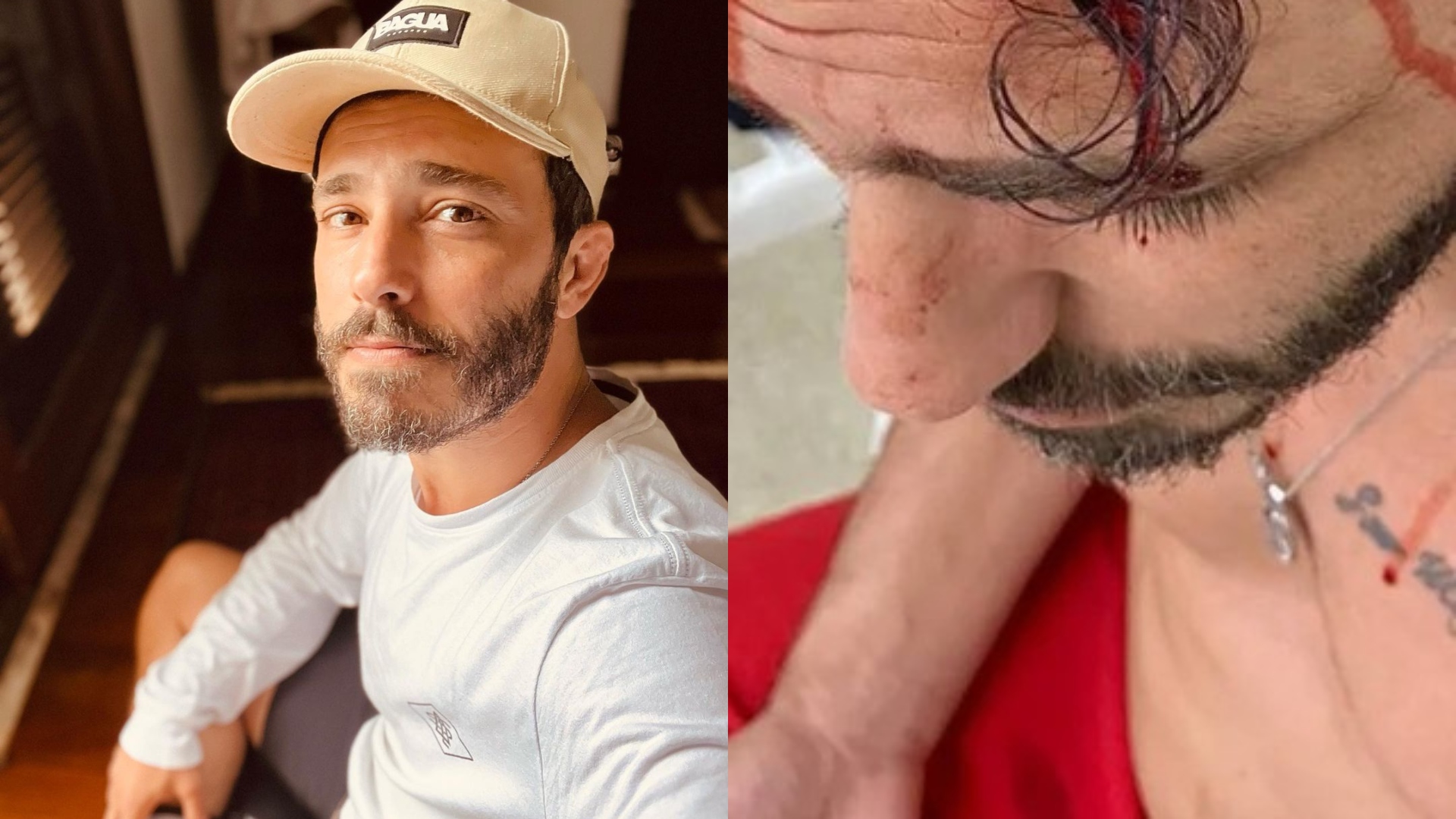 Agressão brutal contra Thiago Rodrigues está sendo investigada; Polícia trabalha com suspeitos