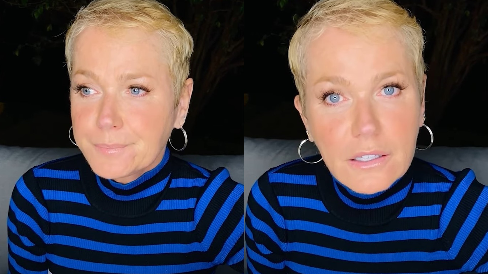 Xuxa atualiza estado de saúde após internação por procedimento estético: “Eu odivava”