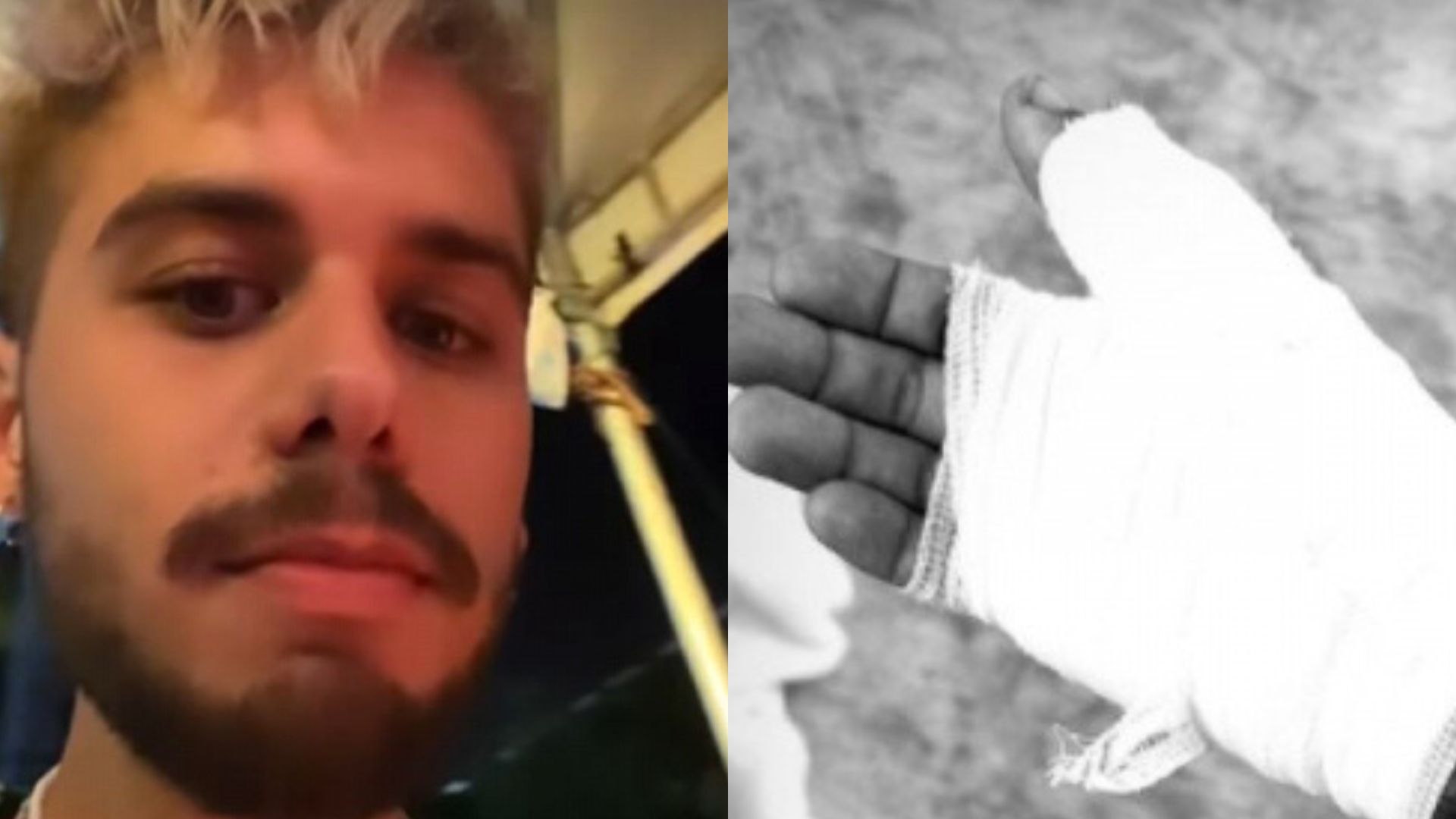 Zé Felipe se corta e é levado às pressas para o hospital: “Tudo rasgado”