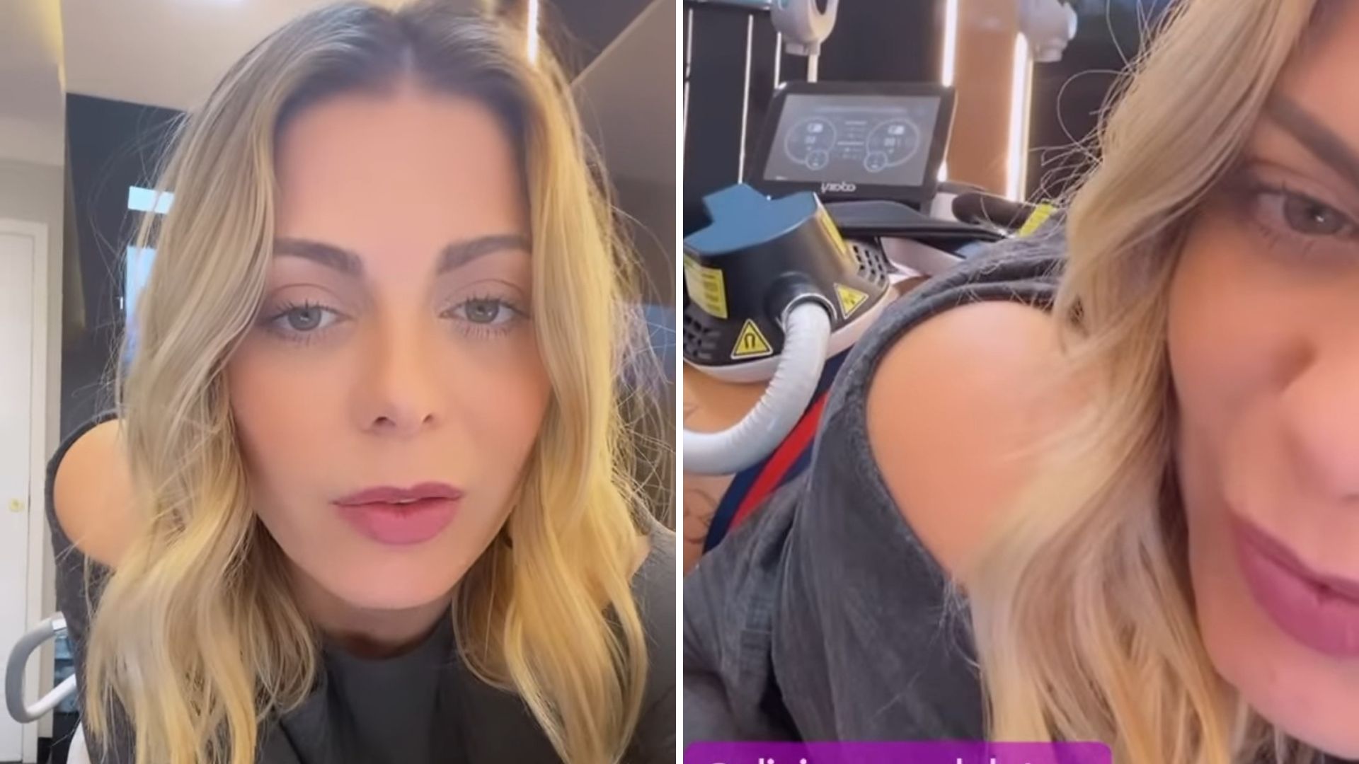 Aos 44 anos, Sheila Mello dá recauchutada no bumbum: “Picadinhas da felicidade”