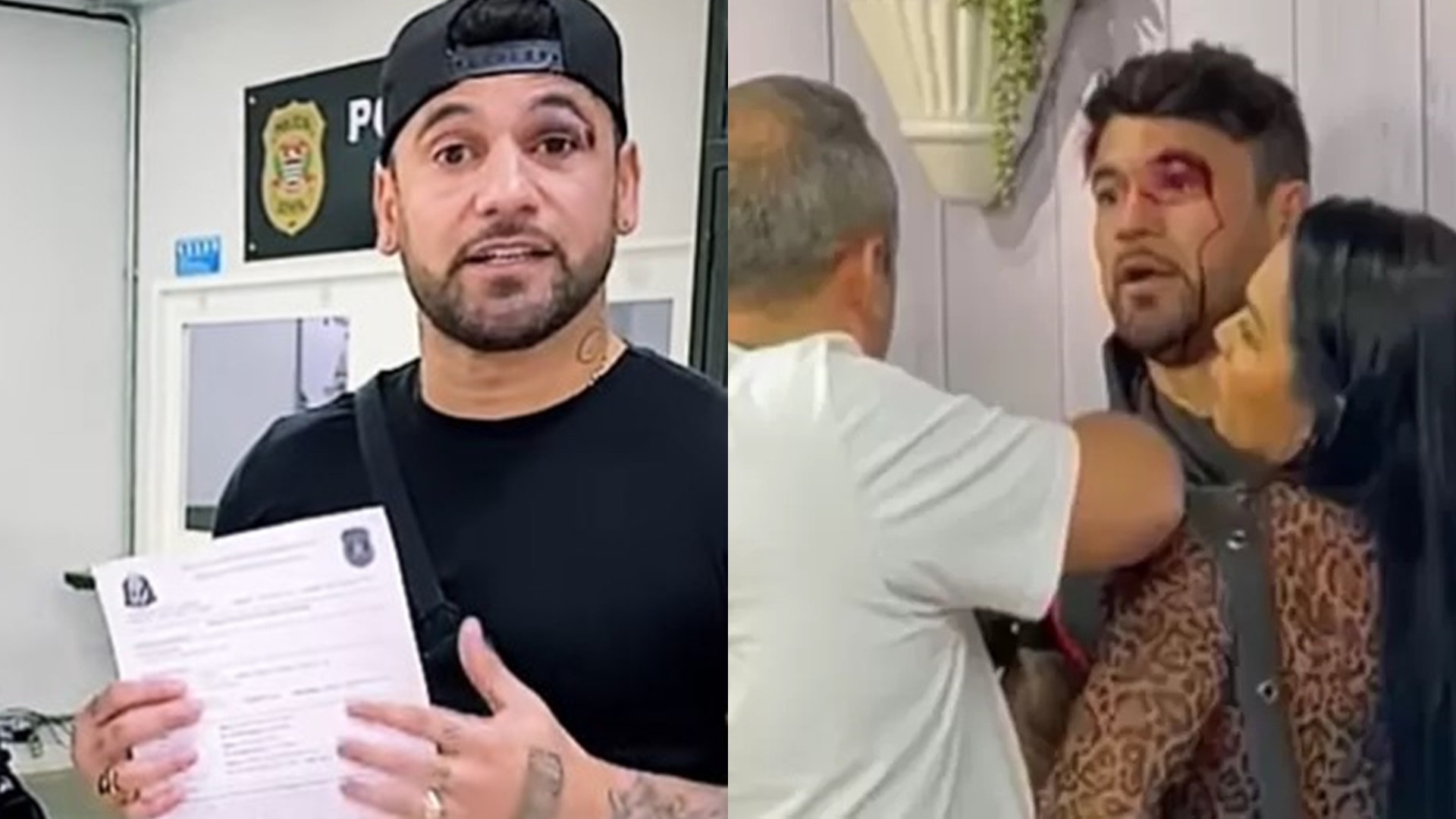 Hadson Nery abre B.O após apanhar de Vini Buttel na Record: “Vão saber toda a verdade”