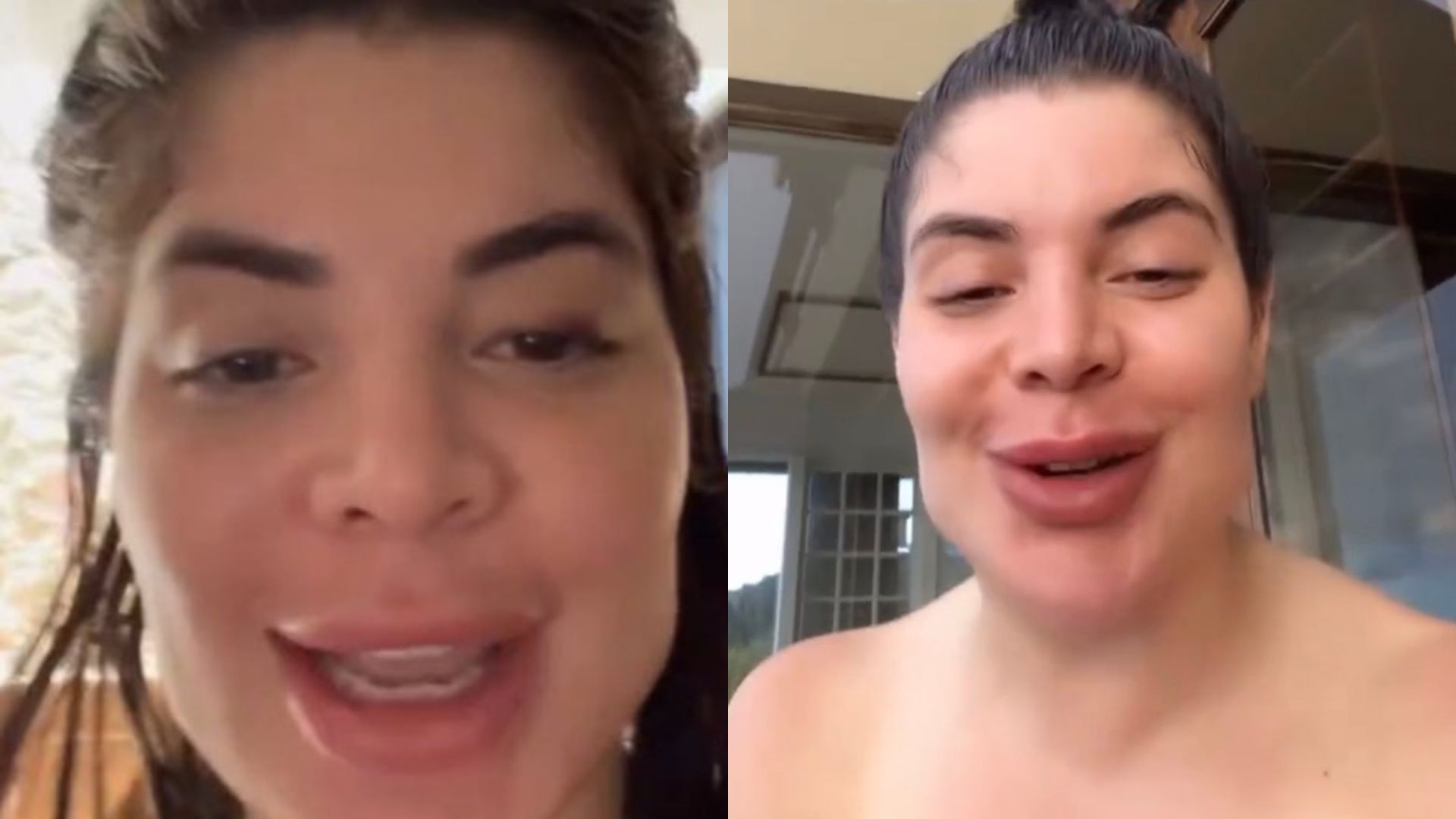 Tá podendo! Gkay gasta valor caríssimo com nova harmonização facial