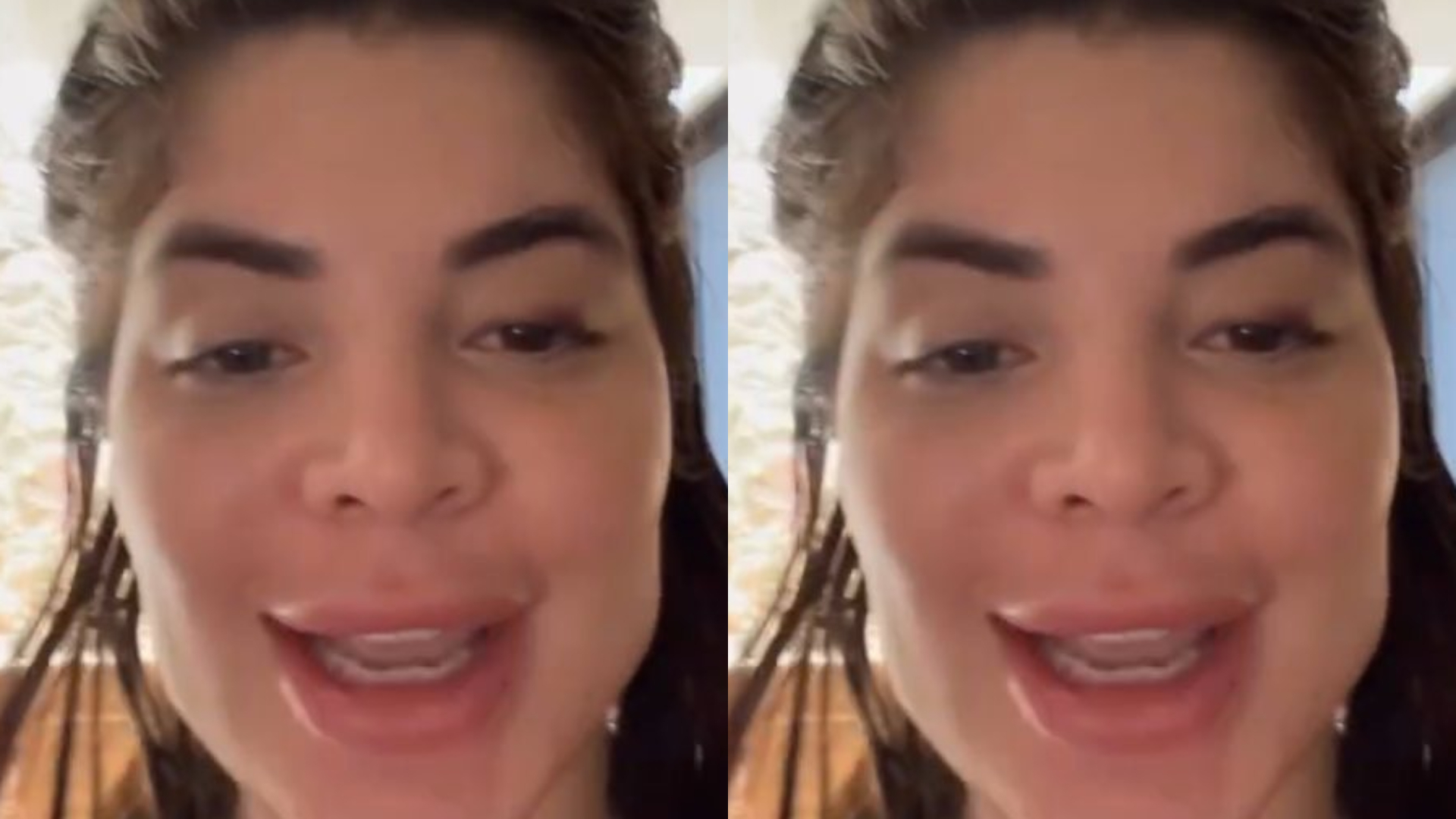Gkay faz harmonização facial e resultado vira chacota na web: “Problema sério”