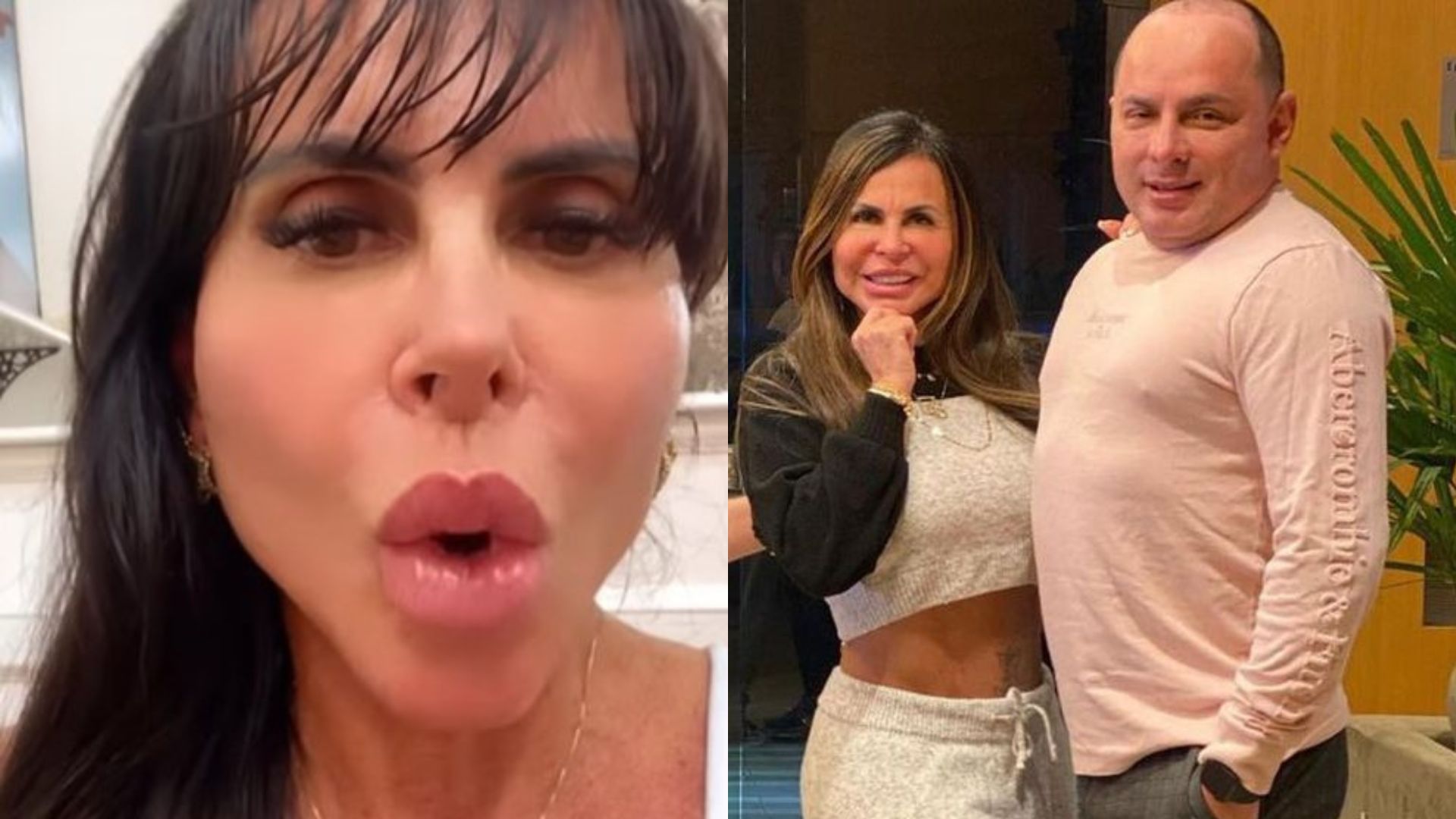 Gretchen surpreende ao mostrar antes e depois de procedimentos estéticos: “Escolhas”