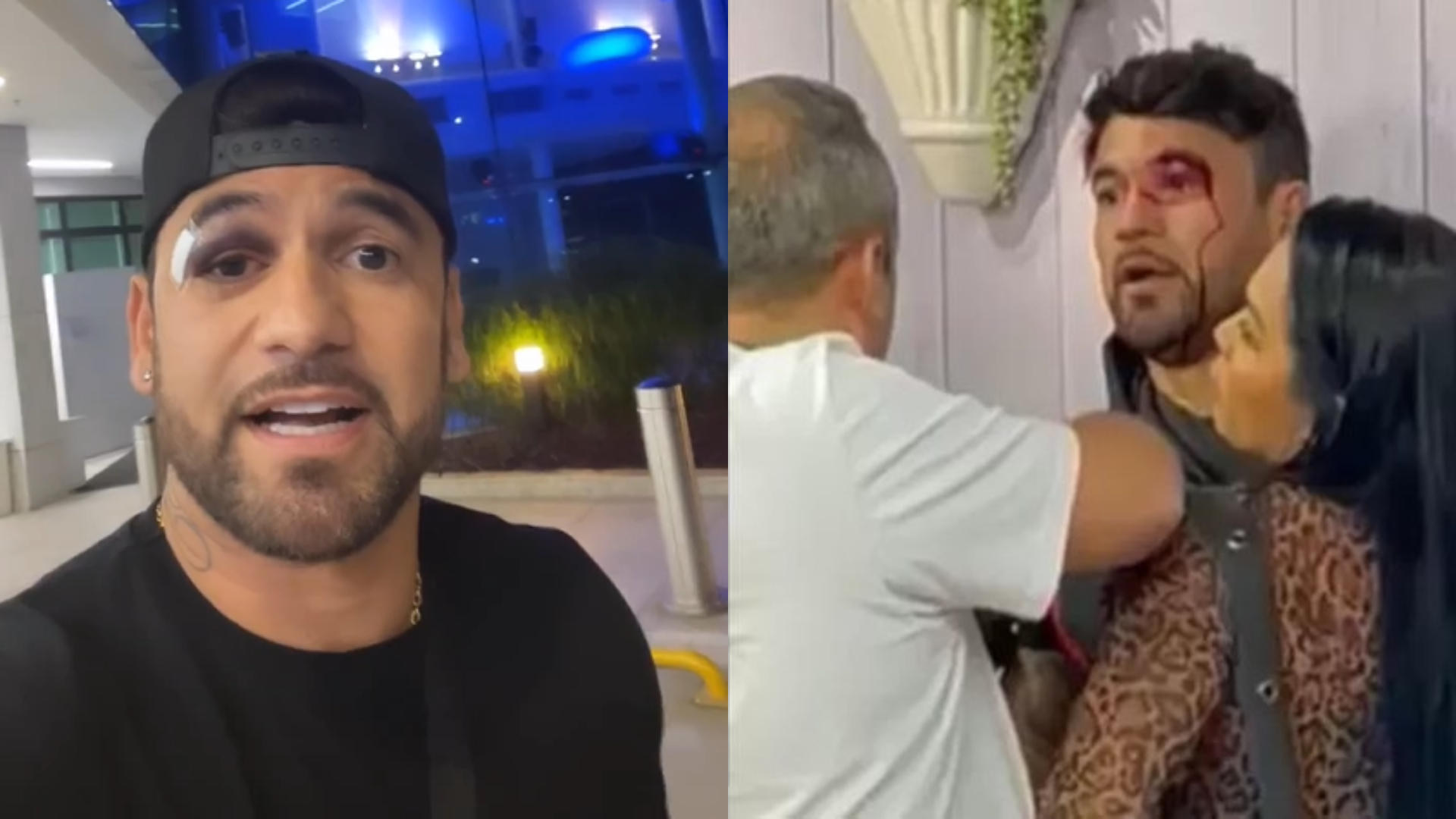 Coberto por hematomas, Hadson revela motivo de pancadaria com Vini: “Não permito”