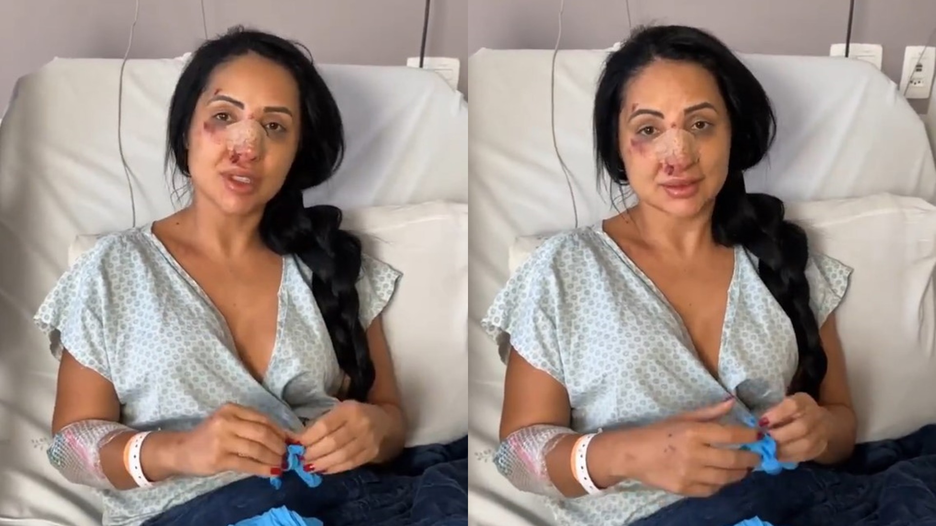 Irmã de Deolane passará por cirurgia após briga em bar e internação às pressas em hospital