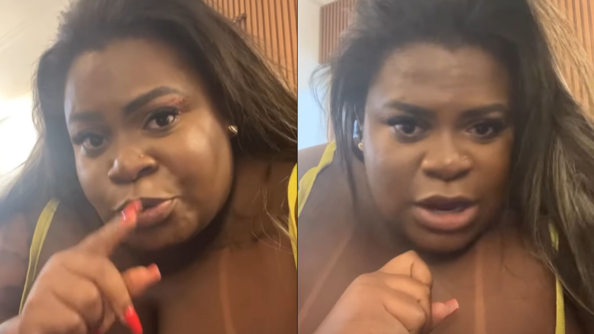 Jojo Todynho nega que cirurgia é resposta a ex-marido: “É um processo”