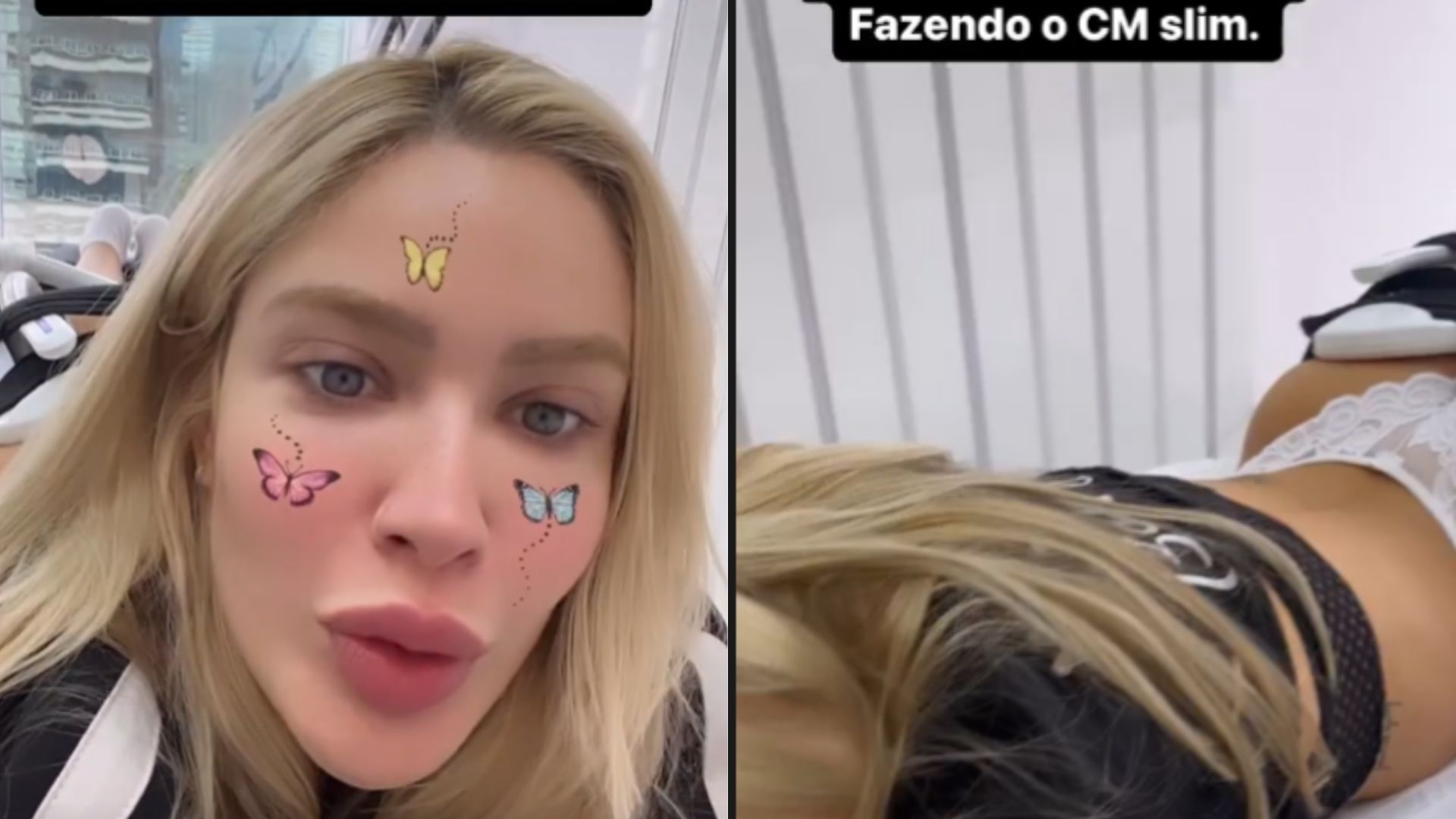 Karoline Lima faz procedimento estético se preparando para a Copa: “É maravilhoso”
