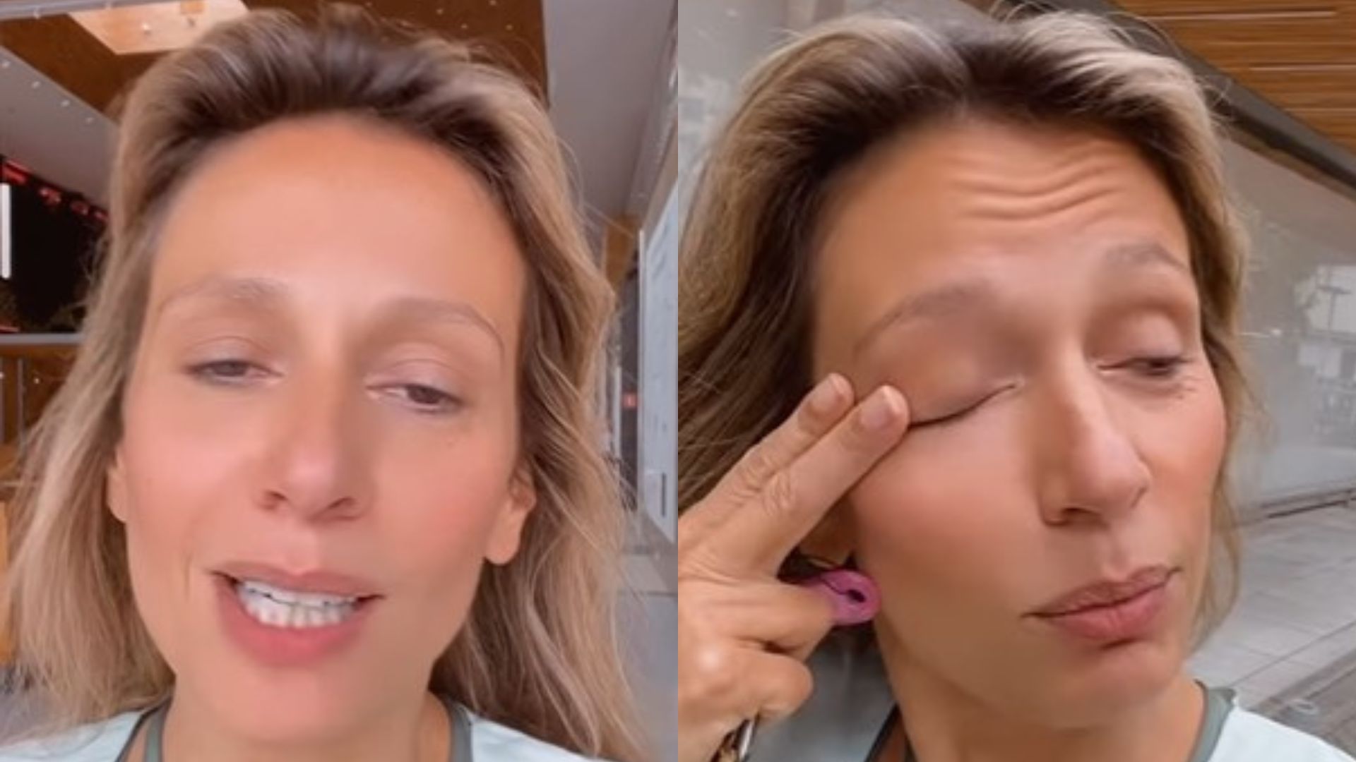 Indignada, Luisa Mell expõe ataque sofrido por bolsonarista na rua e dispara: “Covarde”