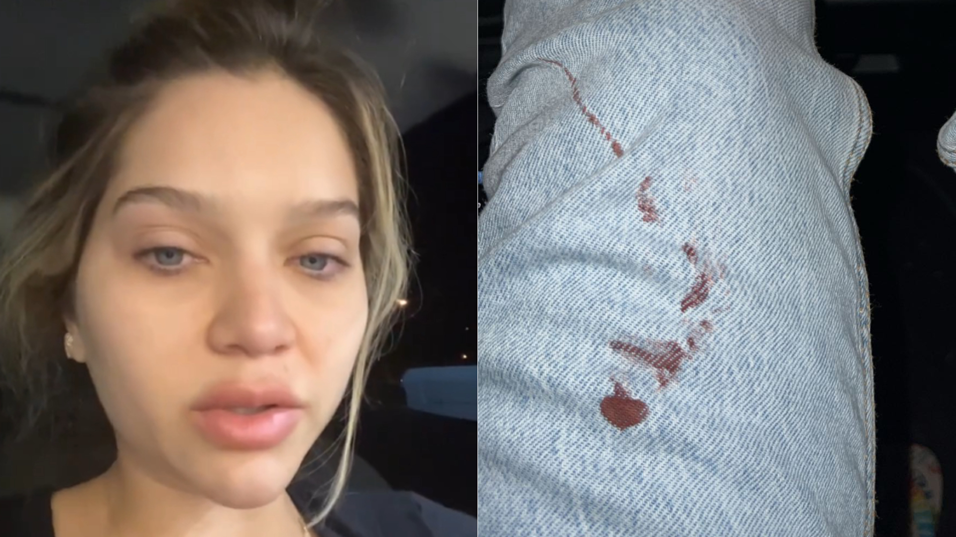 Filha de Leandro sofre fratura e surge com roupa coberta de sangue: “Desesperada”