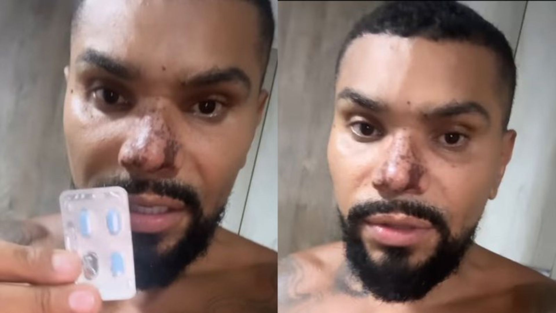 Naldo revela drama após ser obrigado a tomar o comprimidinho azul: “Tá batendo no teto”