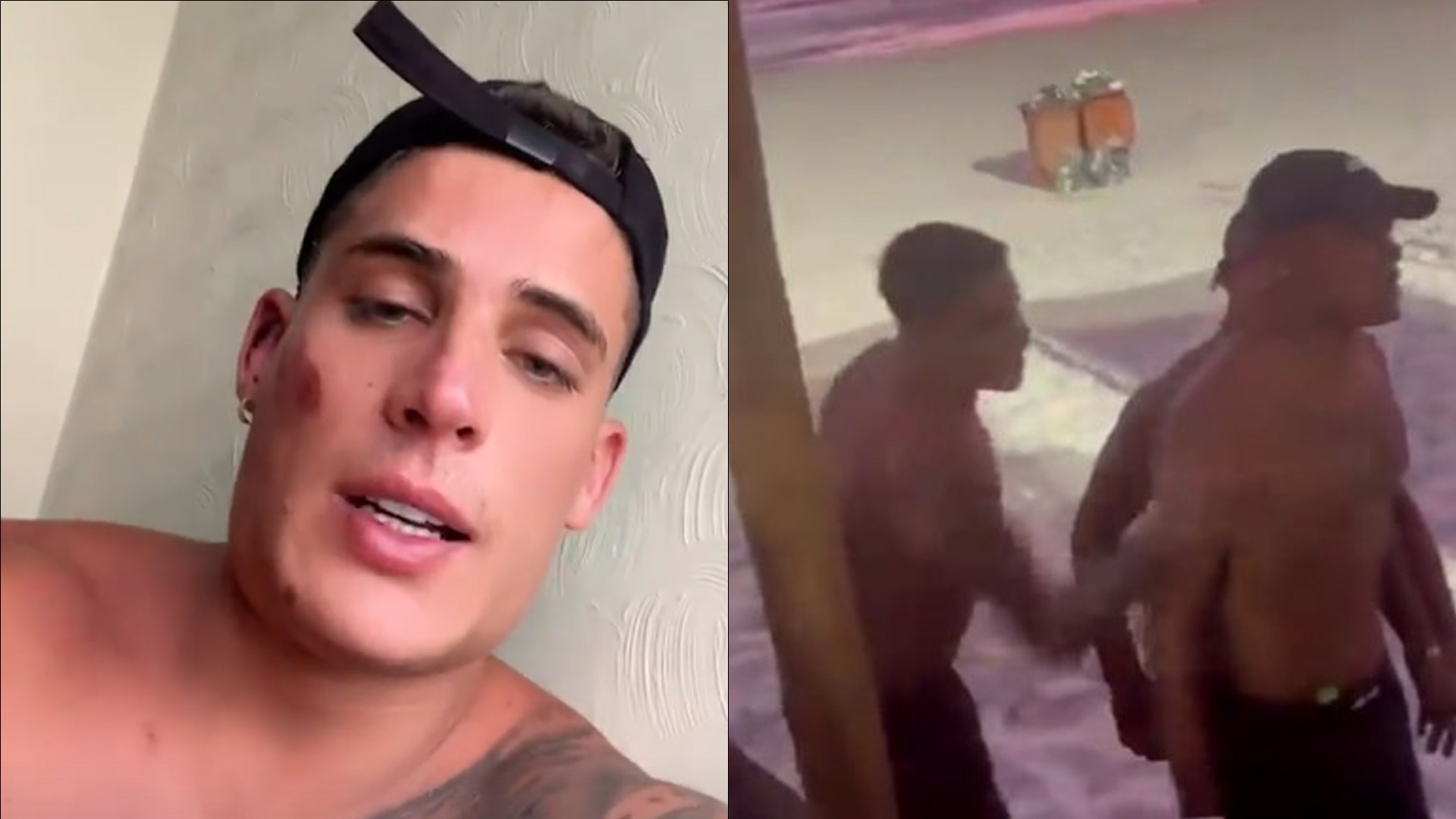 Tiago Ramos surge com rosto machucado após apanhar de homem na praia: “Provocou”