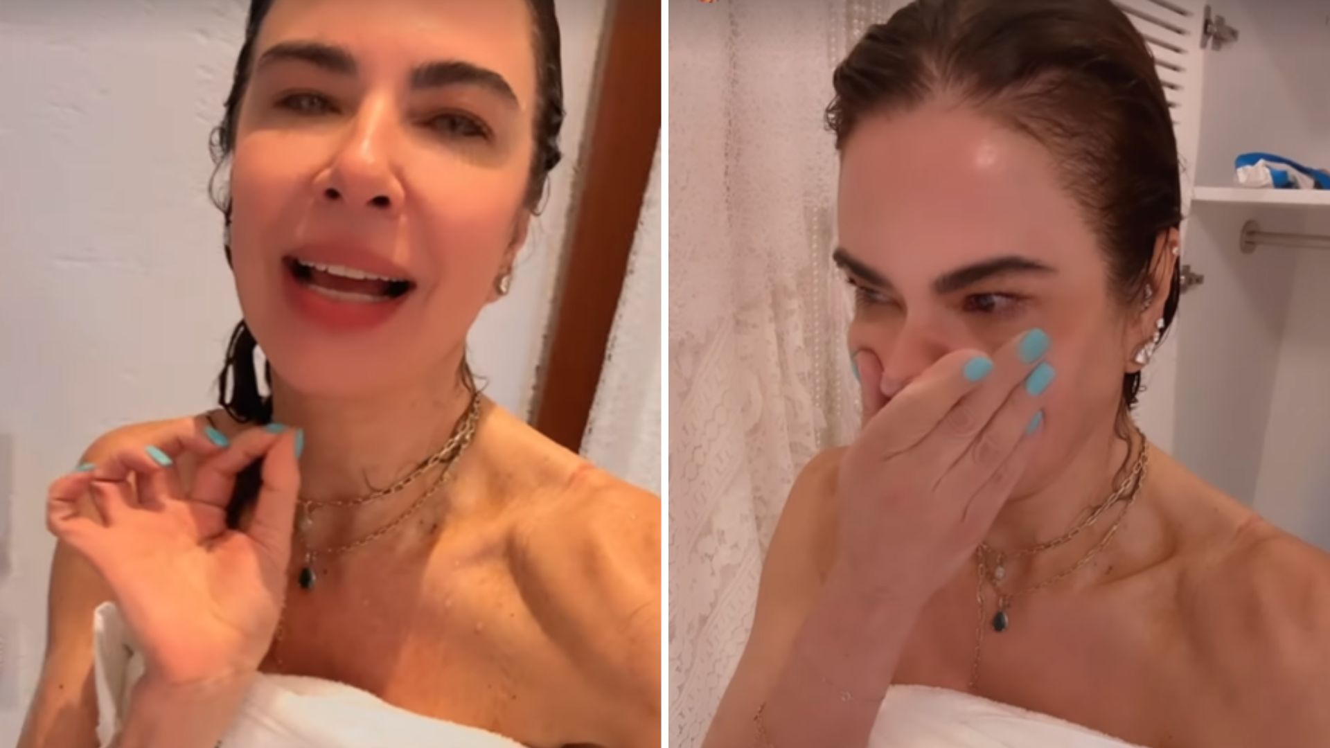 Luciana Gimenez confirma sequelas após grave acidente de esqui: “Não estou 100%”